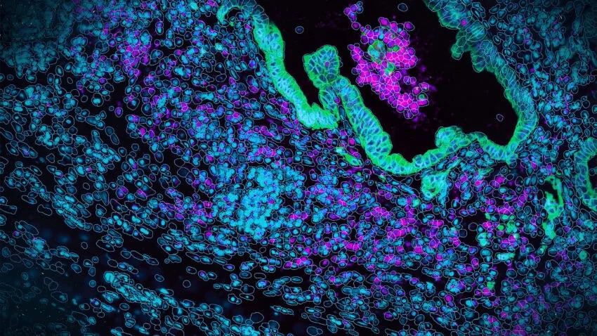 Multiplexed Immunofluorescence Analysis